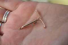 bronze cast of actual mirena iud in the palm of a hand